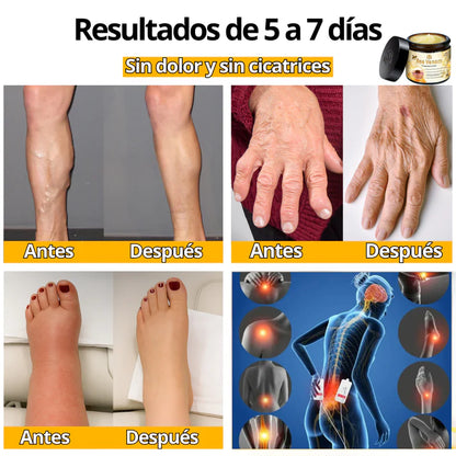 Bee Venom Bswell - Crema Para Dolores con Veneno de Abeja